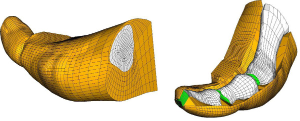 human first ray mesh