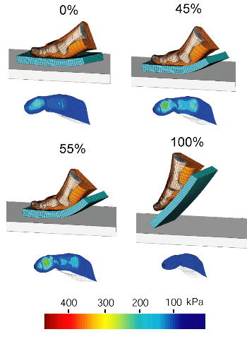 human first ray mesh