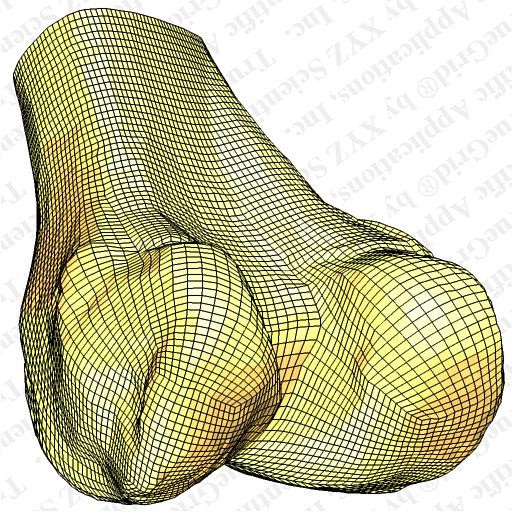 Large Image of Femur