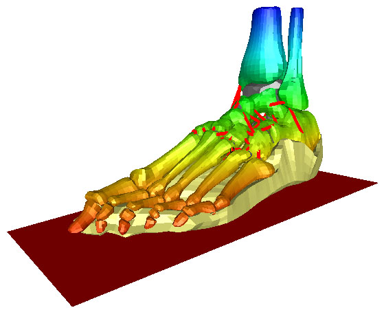 Oblique view of human foot mesh