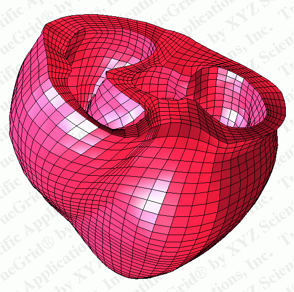 TrueGrid Mesh of the Human Heart