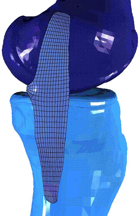 Mesh of knee ligament